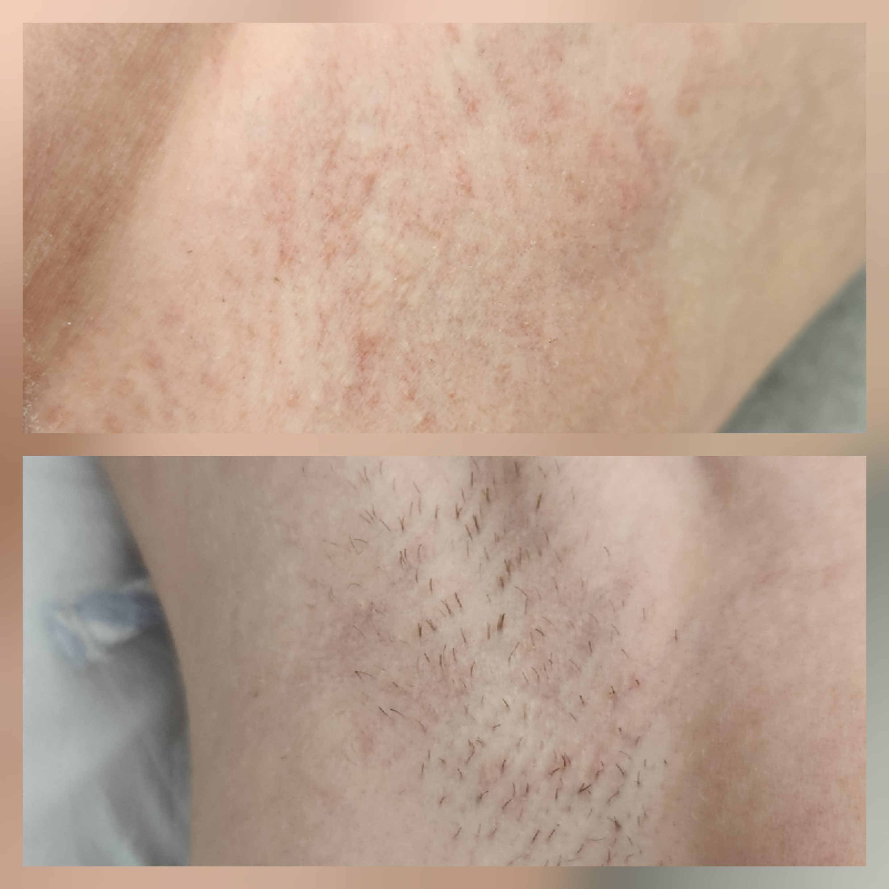Efekt profesjonalnego zabiegu pielęgnacji skóry w Skin Lab Rybnik